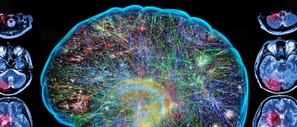 Psilocybin vs. SSRIs: Understanding Two Paths to Mental Wellness 2 a graphic with the outline of a brain filled with the cosmos inside.