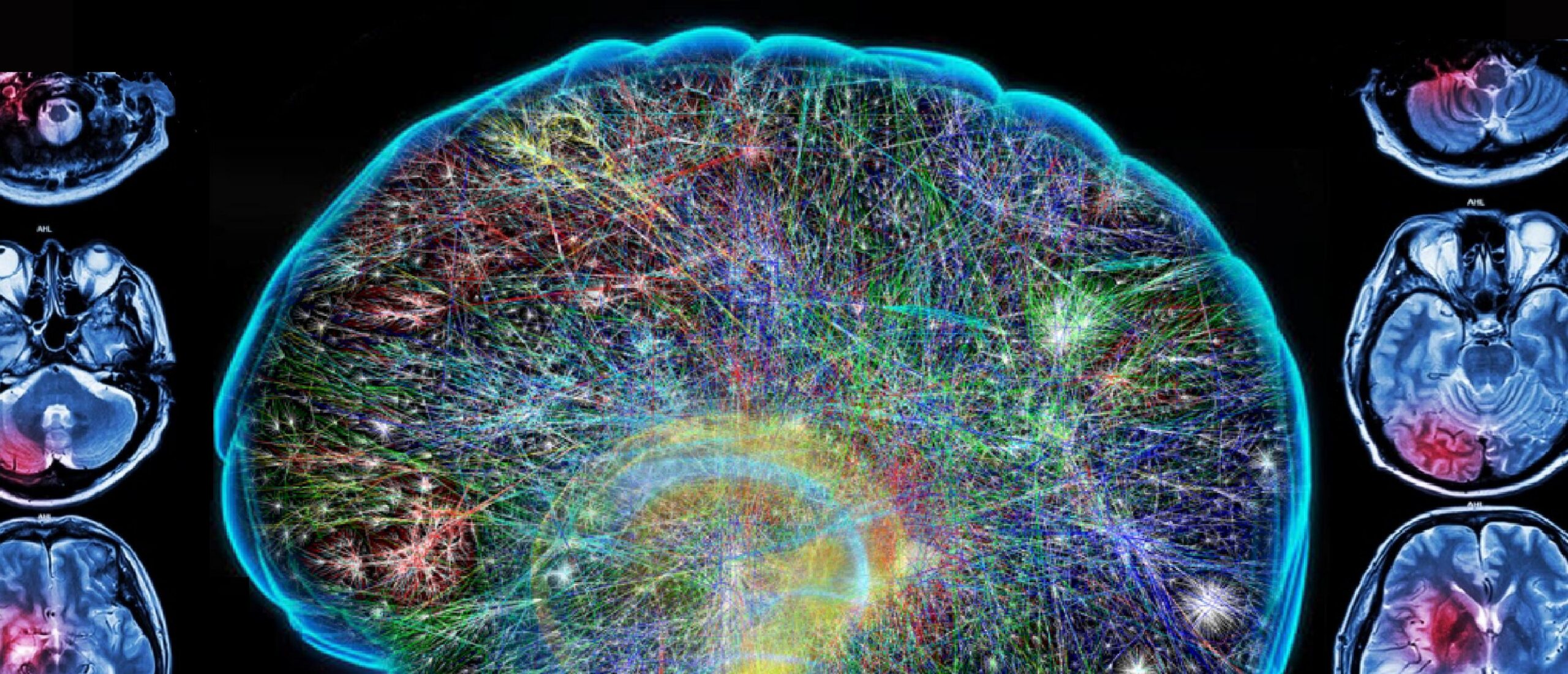 a graphic with the outline of a brain filled with the cosmos inside.