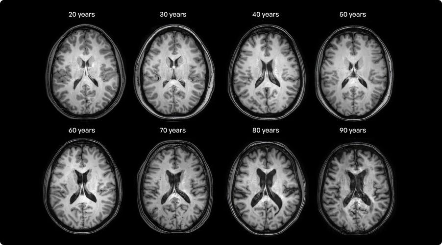 Exploring psilocybin and cognitive aging