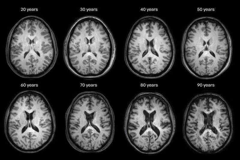 Exploring psilocybin and cognitive aging